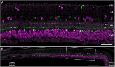 Developmental errors in the common marmoset retina